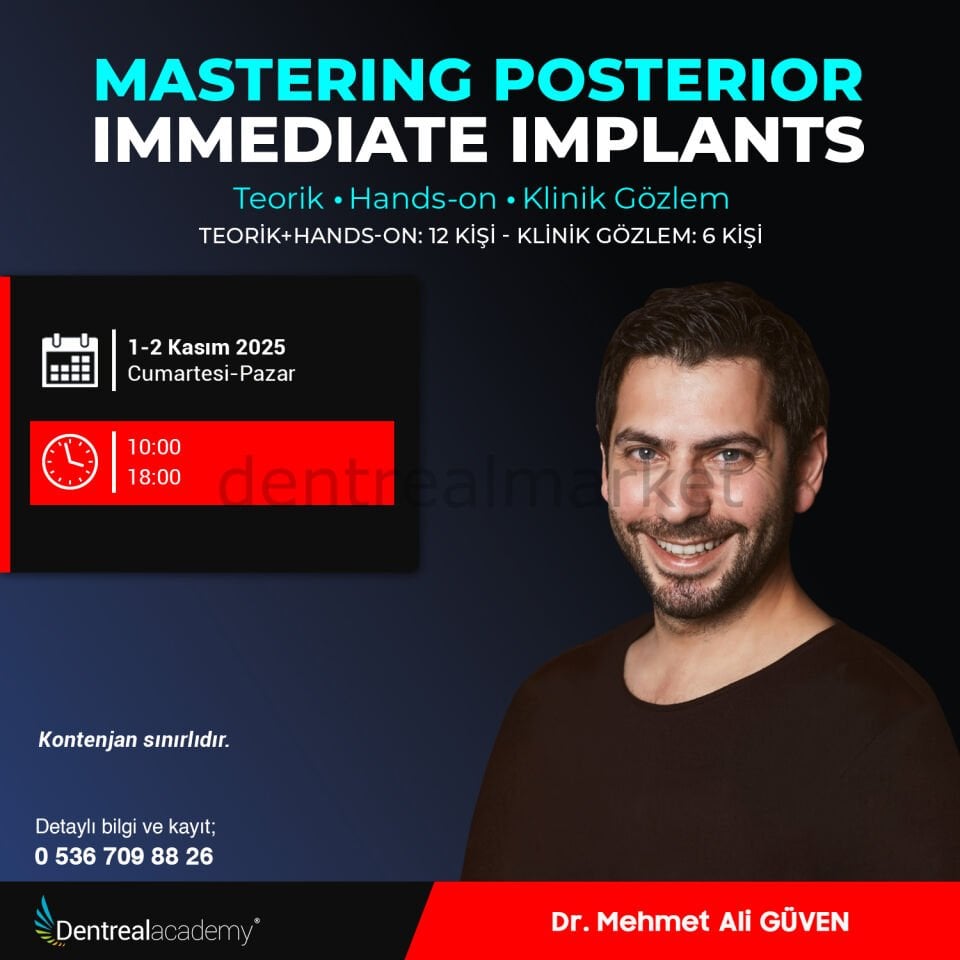 Mastering Posterior Immediate Implants Teorik+Hands-on - Klinik Gözlem -  Dr. Mehmet Ali Güven