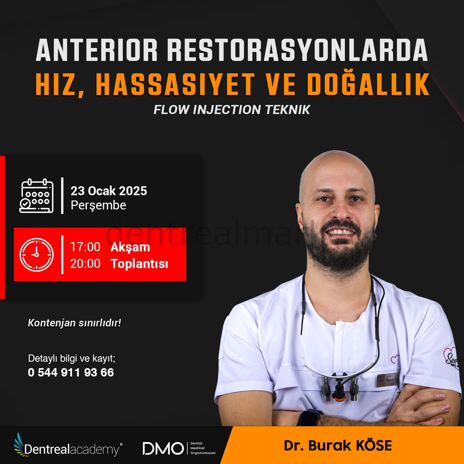 Anterior Restorasyonlarda Hız, Hassasiyet ve Doğallık Flow Injection Teknik - Dr. Burak Köse