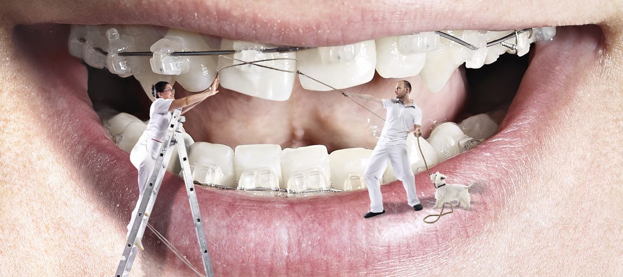 Orthodonti Başlangıç Seti V3