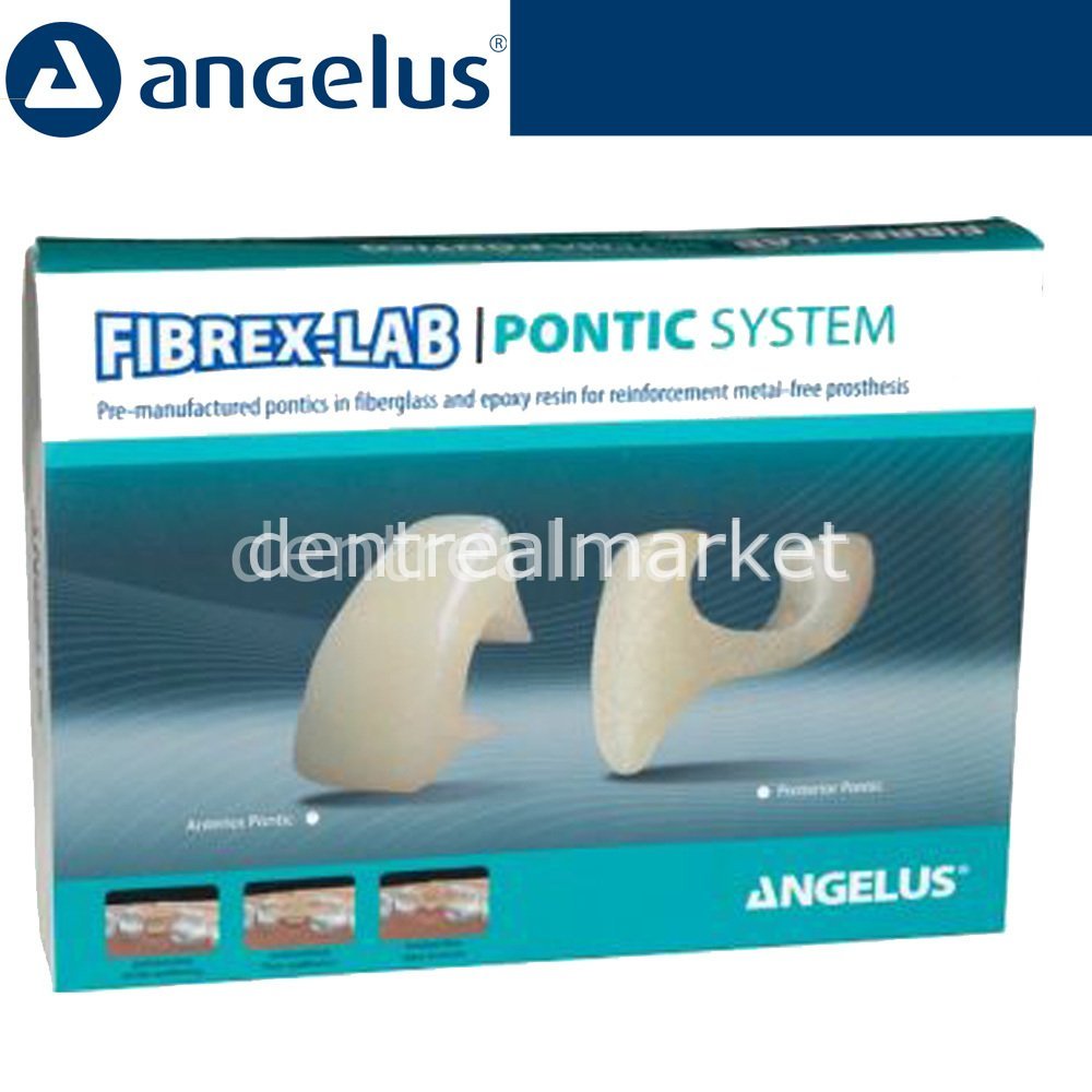 Fibrex-Lab Pontic System Kit