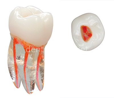 Training Tooth Molar Egitim Dişi