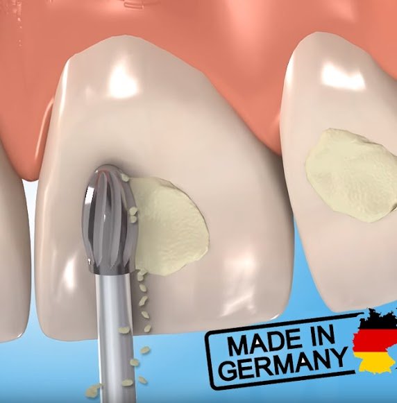 frank dental orthodonti frezi