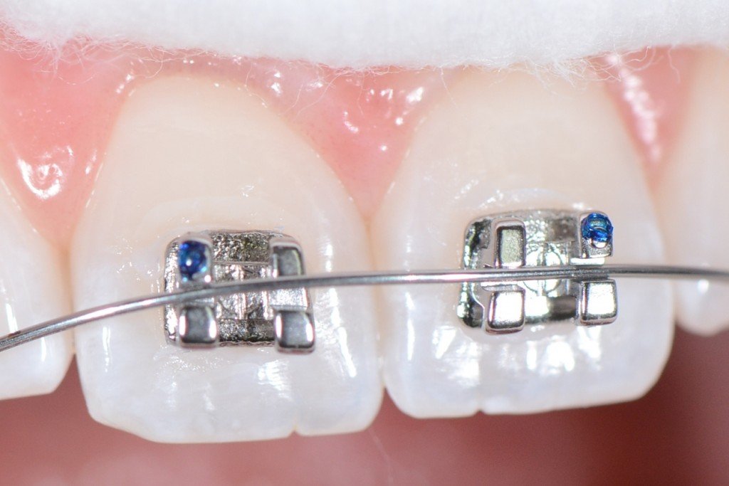 frank dental debondig frezi,orthodontic siaman temizleme frezi