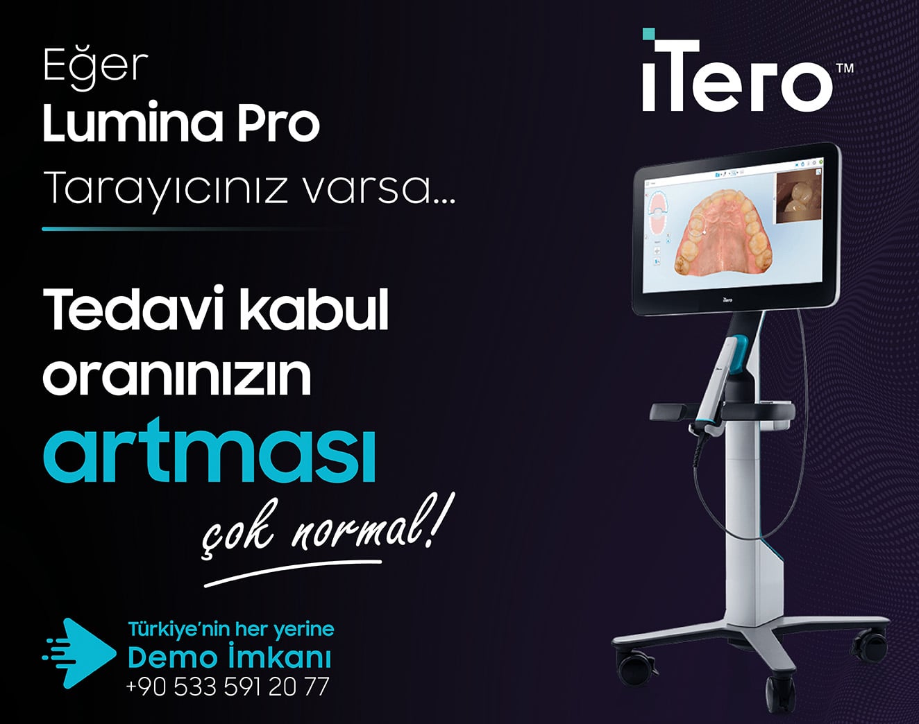 İtero Lumina tarayıcı