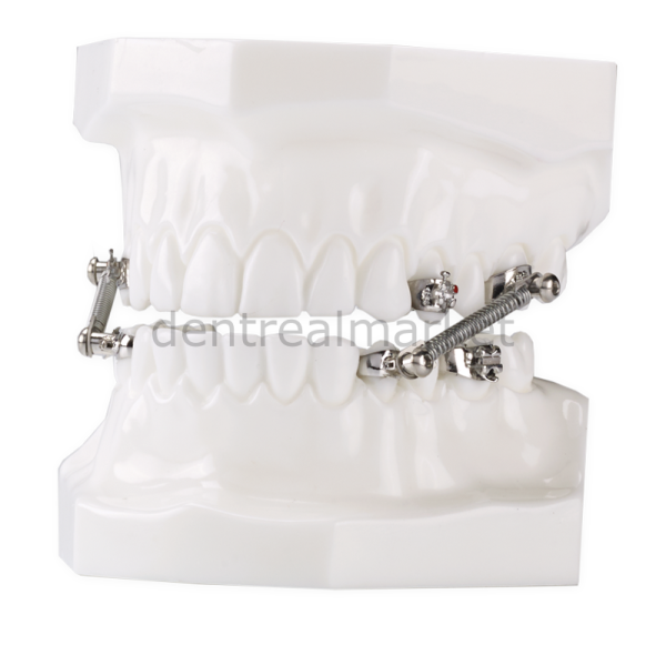 CS-2000 10 Patient Kit