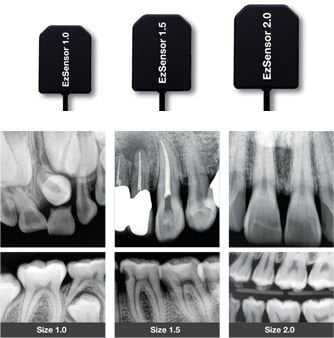 RVG EZSensör Sensör Classic - Dental Radyografi Cihazı
