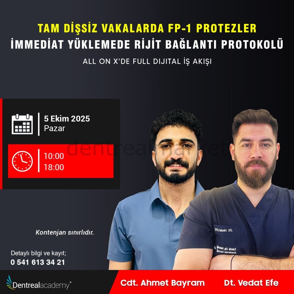 Tam Dişsiz Vakalarda FP-1 Protezler İmmediat Yüklemede Rijit Bağlantı Protokolü  - Dt Vedat Efe