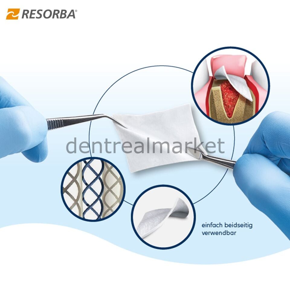 Easy Flex - Esnetilebilir Collagen Membran 20*30 mm - 5+1 Kampanya