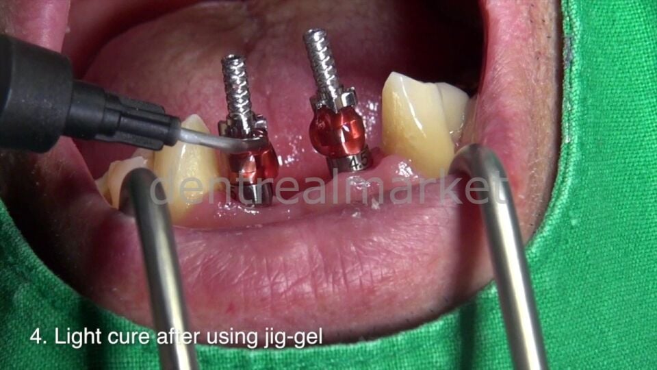 Jig Gel Işıkla Sertleşen Pattern Resin 12ml-(14gr)