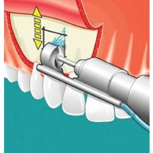 Cerrahi Testere 2444 Mikro Cerrahi Anguldurva Set