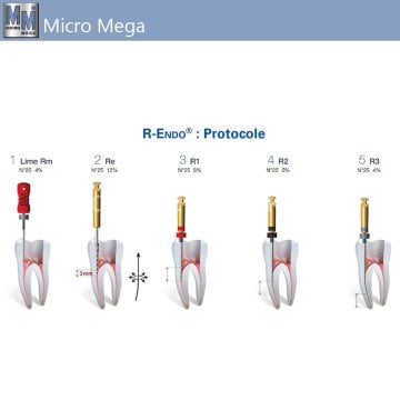 R-Endo Classic Kanal Egesi