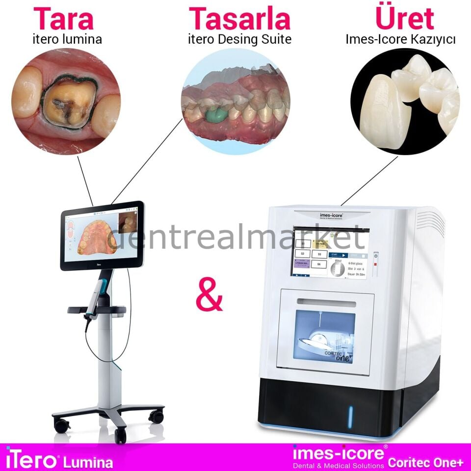 CORiTEC one Chairside Kazıyıcı & İtero Lumina Tarayıcı