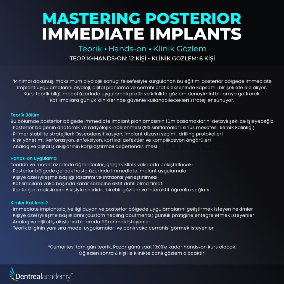 Mastering Posterior Immediate Implants Teorik+Hands-on - Klinik Gözlem -  Dr. Mehmet Ali Güven