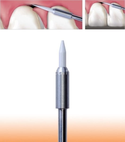 Gingiva Trimmer Yumuşak Doku Frezi