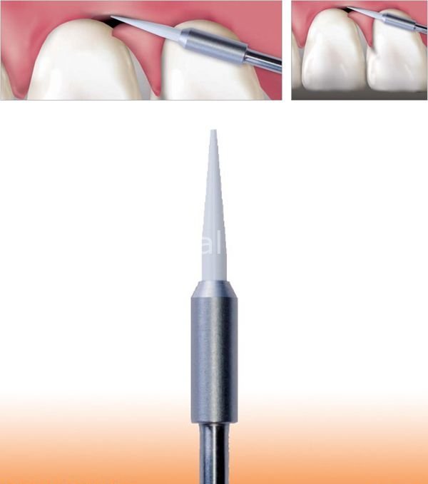 Gingiva Trimmer Yumuşak Doku Frezi