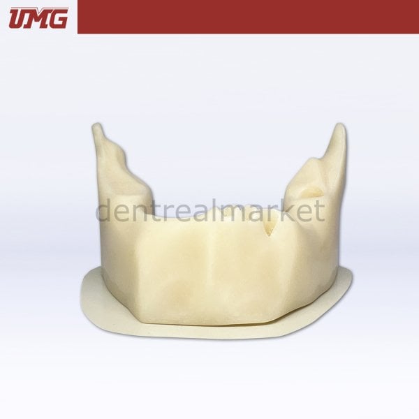 İmplant Yerleştirme Uygulaması için Anatomik Şekilli Kemik Mandibula