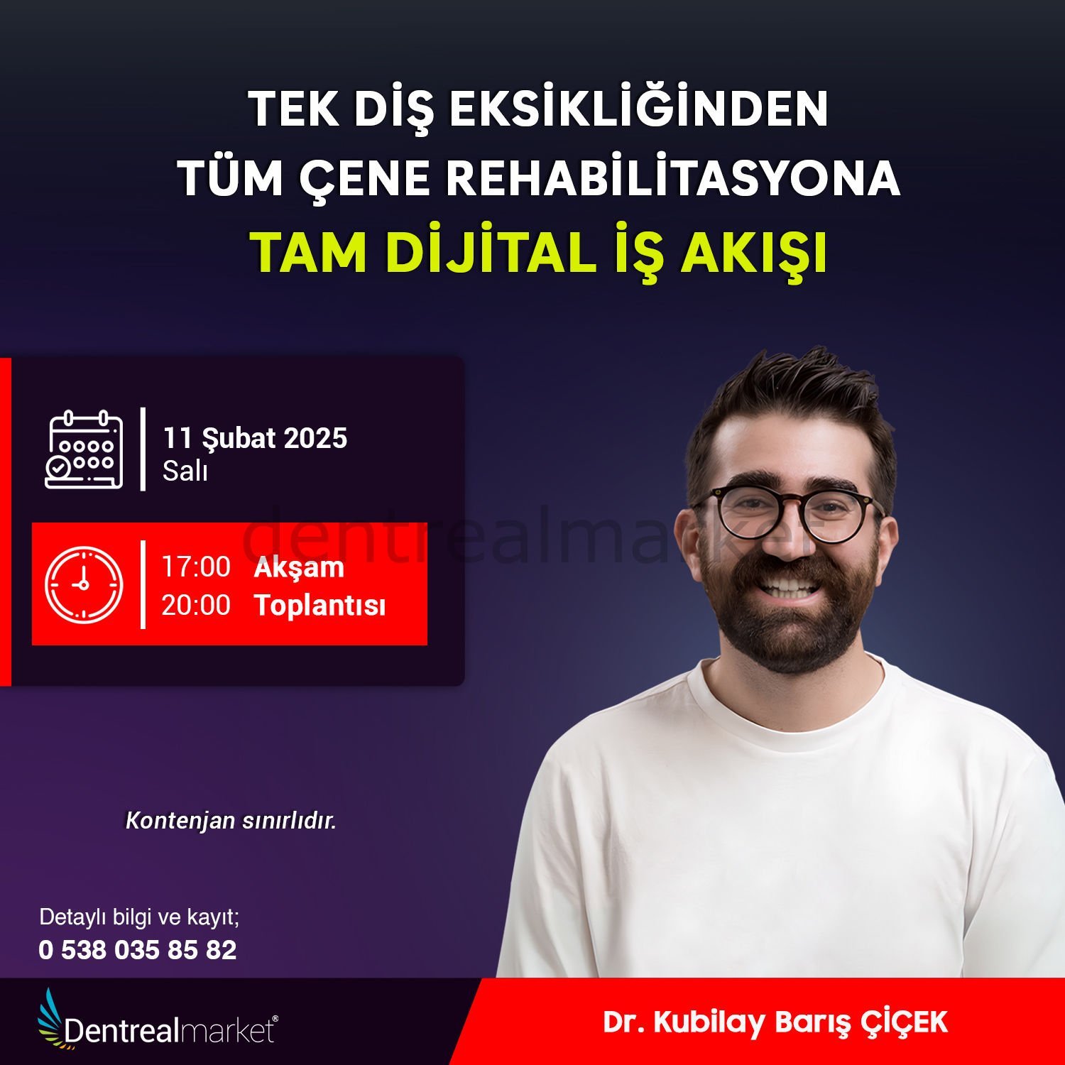 Tek Diş Eksikliğinden Tüm Çene Rehabilitasyonuna Tam Dijital İş Akışı - Dr. Kubilay Barış Çiçek