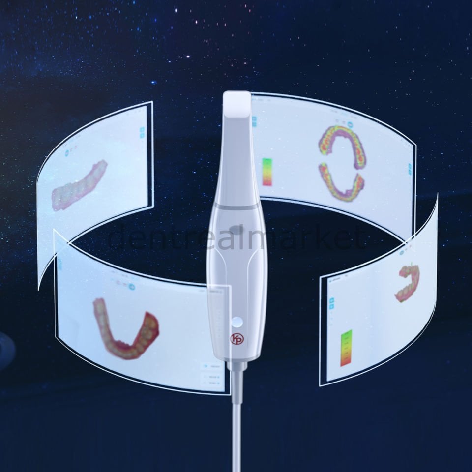 Woodpecker Smile Scan Intraoral - Ağız İçi Tarayıcı Cihazı