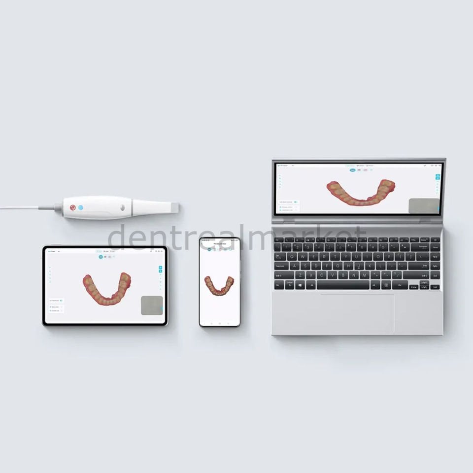 Woodpecker Smile Scan Intraoral - Ağız İçi Tarayıcı Cihazı