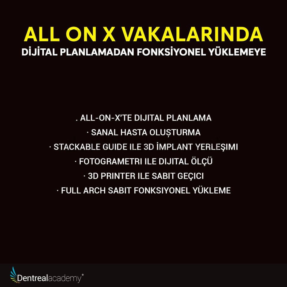 All On X Vakalarında Dijital Planlamadan Fonksiyonel Yüklemeye -  Dr. Mithat Terzi