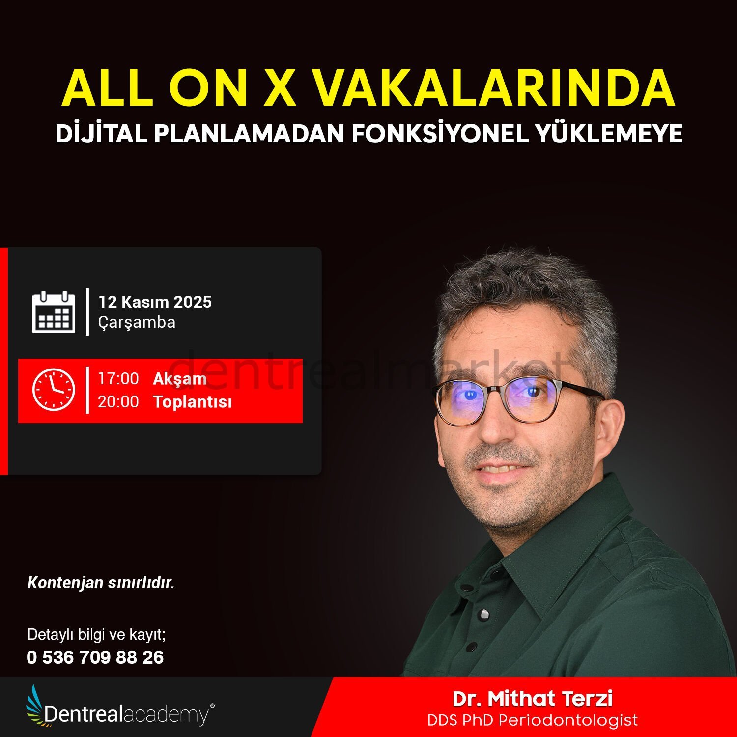 All On X Vakalarında Dijital Planlamadan Fonksiyonel Yüklemeye -  Dr. Mithat Terzi