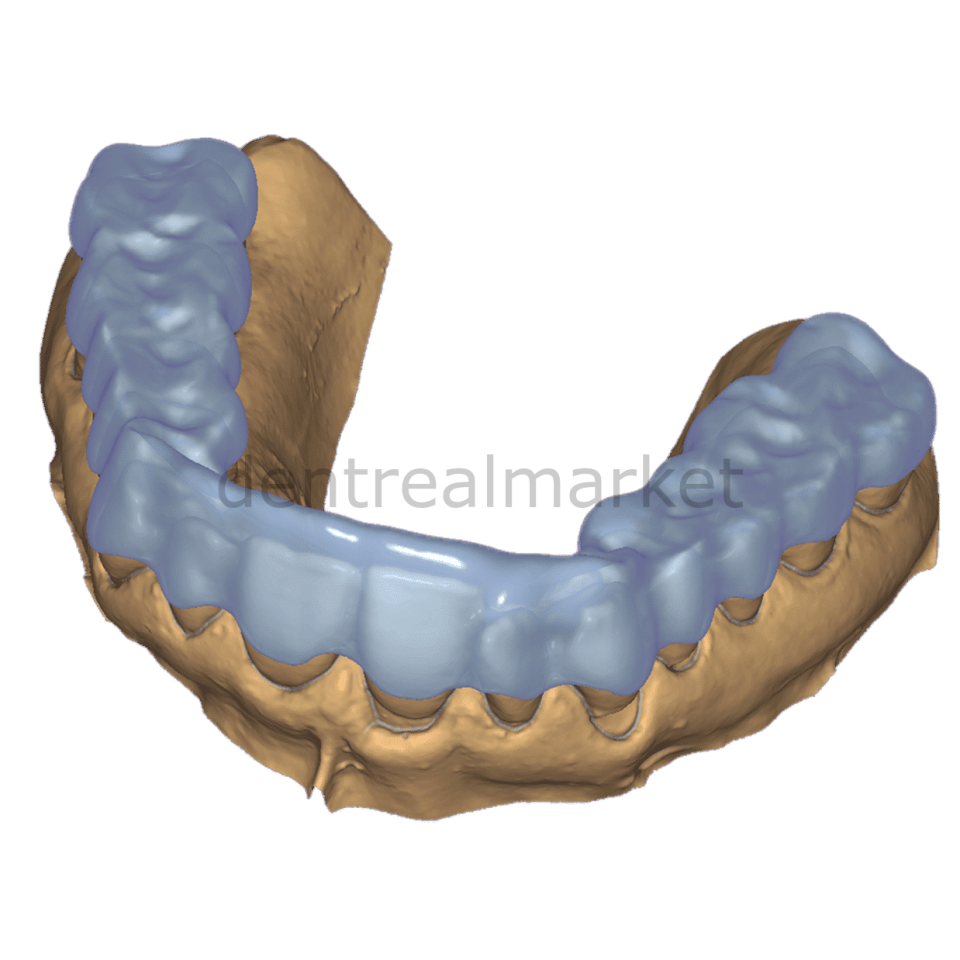 Exocad ChairsideCAD Bite Splint Module