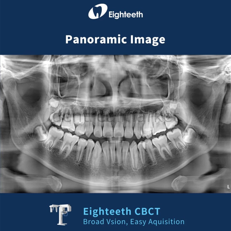 FinScan F350 Volumetrik Tomografi, Panoramik Röntgen Sistemi