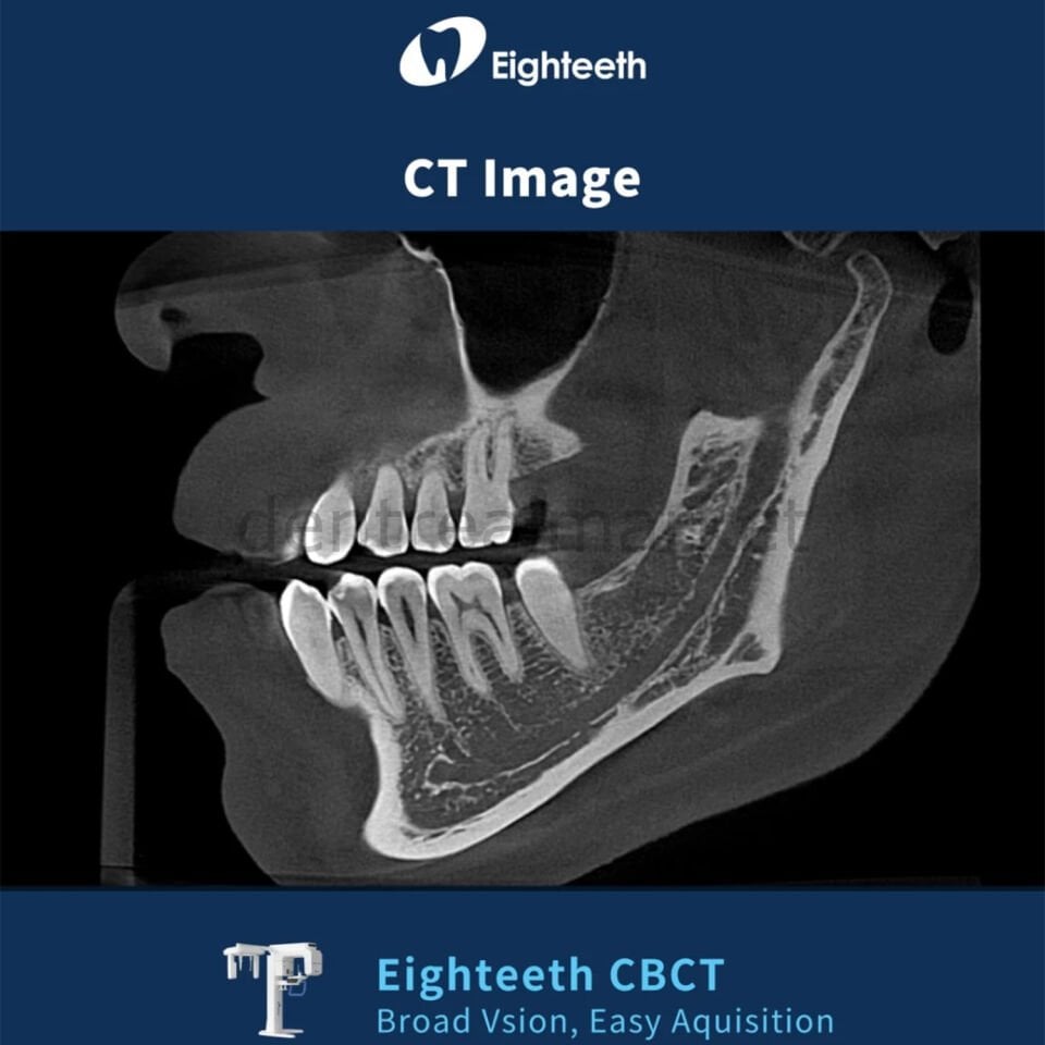 FinScan F350 Volumetrik Tomografi -  Sefalometrik ve Panoramik Röntgen Sistemi
