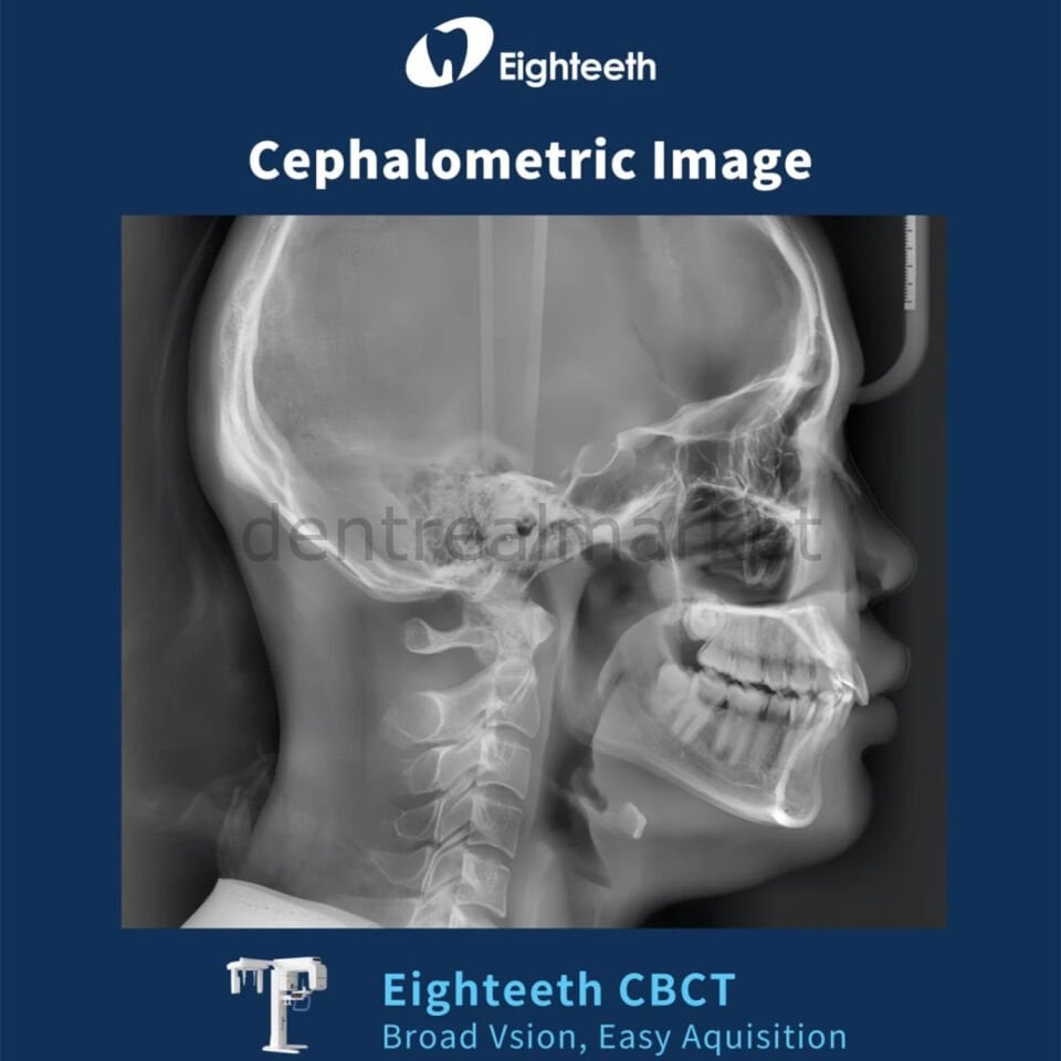 FinScan F350 Volumetrik Tomografi -  Sefalometrik ve Panoramik Röntgen Sistemi