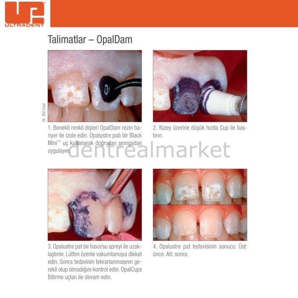 Opalustre Florozisli Dişler İçin Beyazlatma 2'li