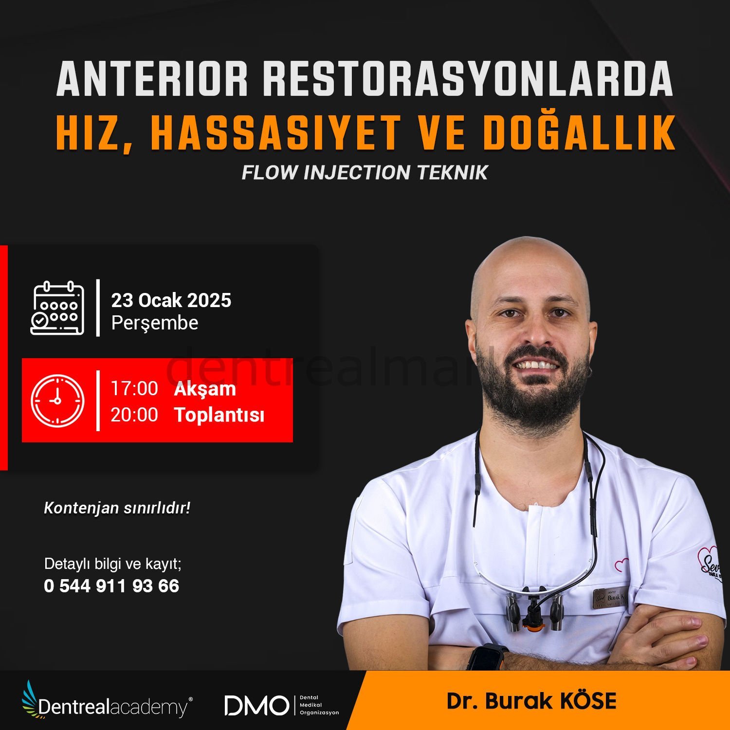 Anterior Restorasyonlarda Hız, Hassasiyet ve Doğallık Flow Injection Teknik - Dr. Burak Köse