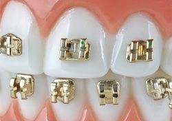 Forever Gold Metal Braket