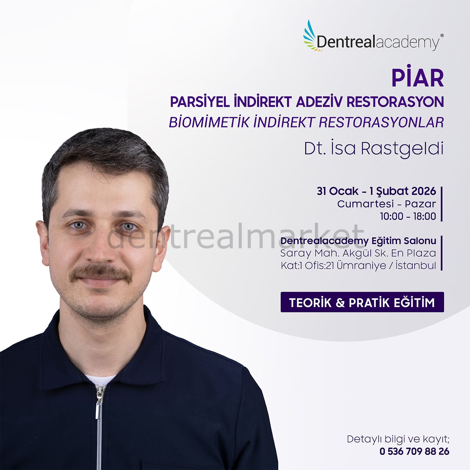PİAR - Parsiyel İndirekt Adeziv Restorasyon - Biomimetik İndirekt Restorasyonlar - Dt. İsa Rastgeldi
