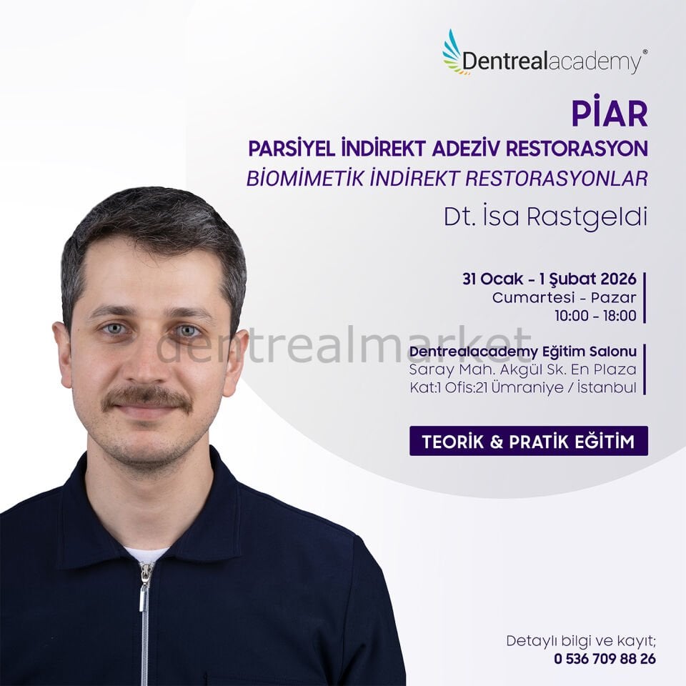 PİAR - Parsiyel İndirekt Adeziv Restorasyon - Biomimetik İndirekt Restorasyonlar - Dt. İsa Rastgeldi