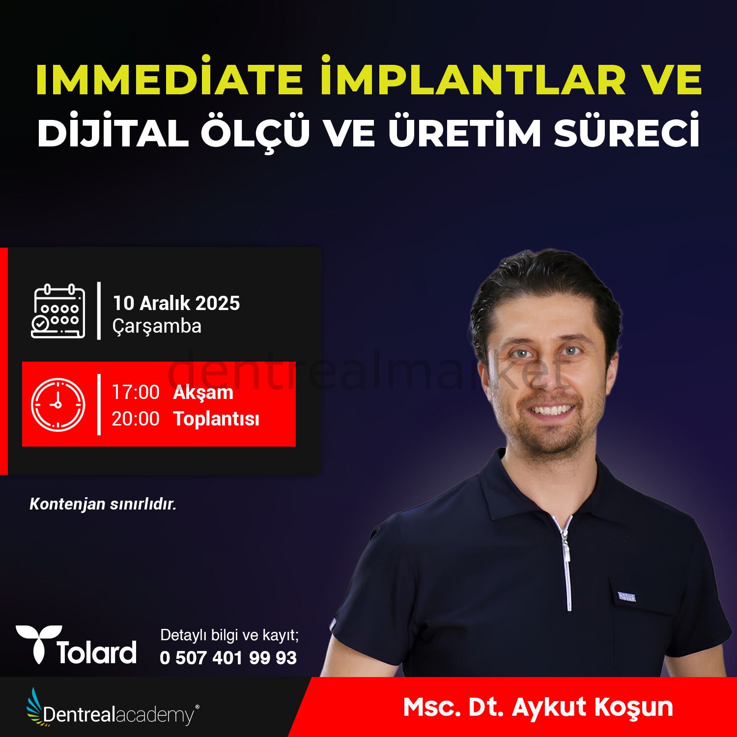 Immediate İmplantlar ve Dijital Ölçü ve Üretim Süreci - Msc. Dt. Aykut Koşun