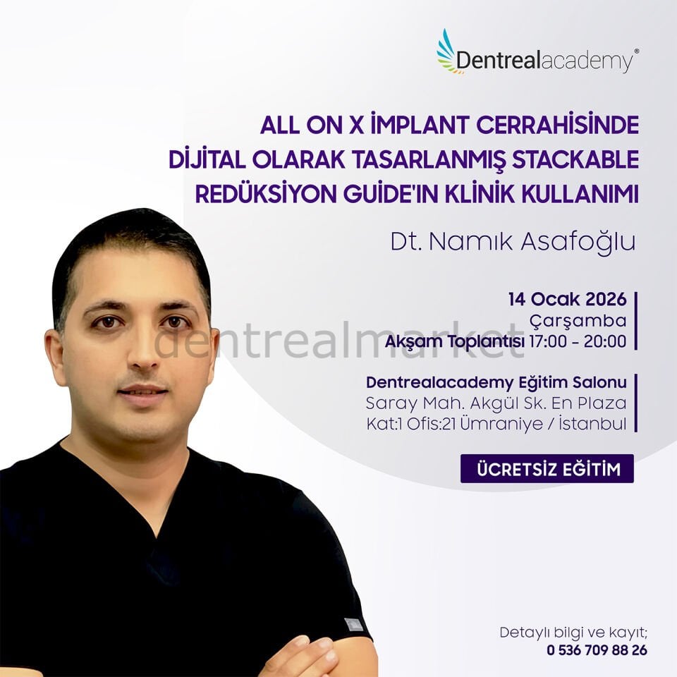 All On X İmplant Cerrahisinde Dijital Olarak Tasarlanmış Stackable Redüksiyon Guide'ın Klinik Kullanımı - Dt. Namık Asafoğlu