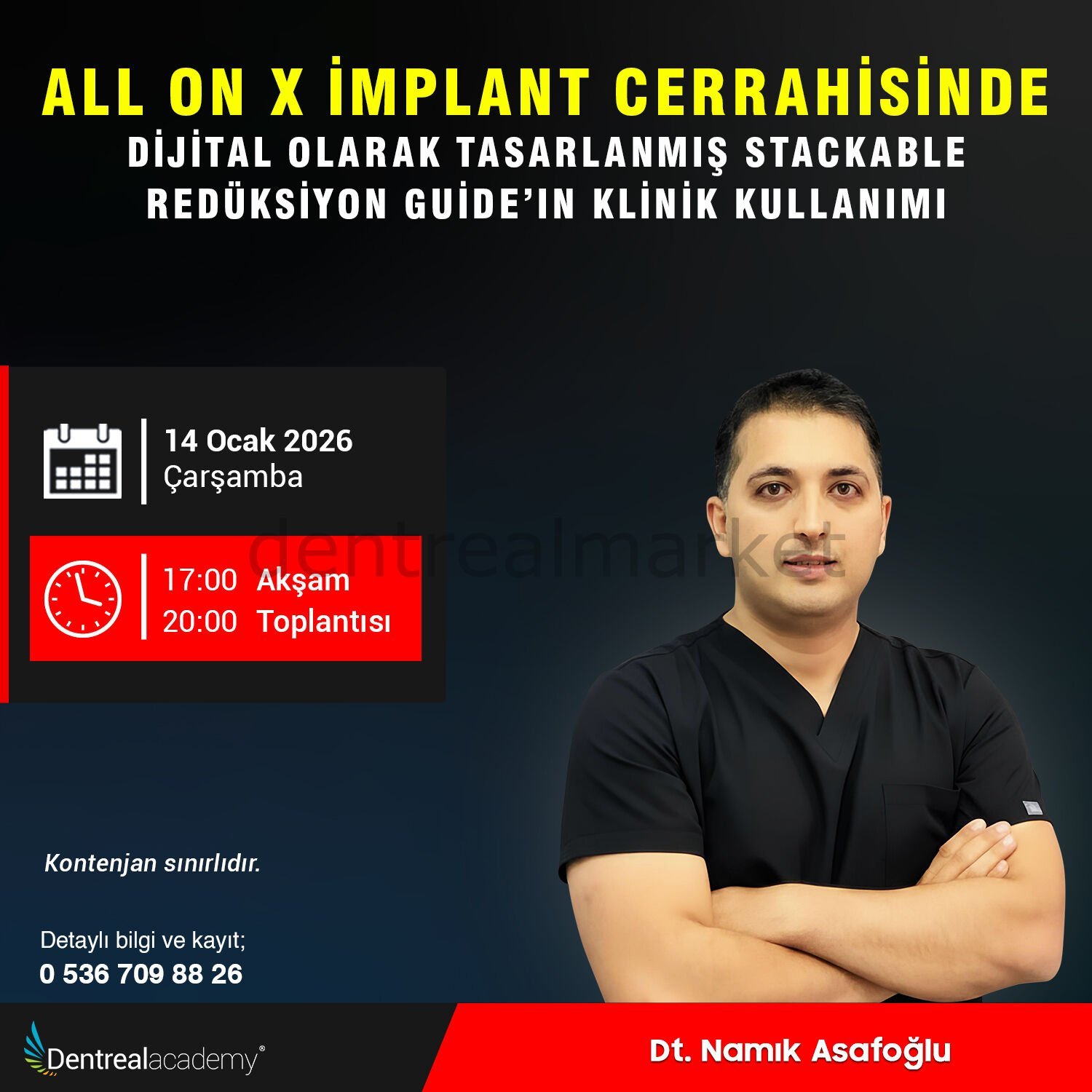 All On X İmplant Cerrahisinde Dijital Olarak Tasarlanmış Stackable Redüksiyon Guide'ın Klinik Kullanımı - Dt. Namık Asafoğlu