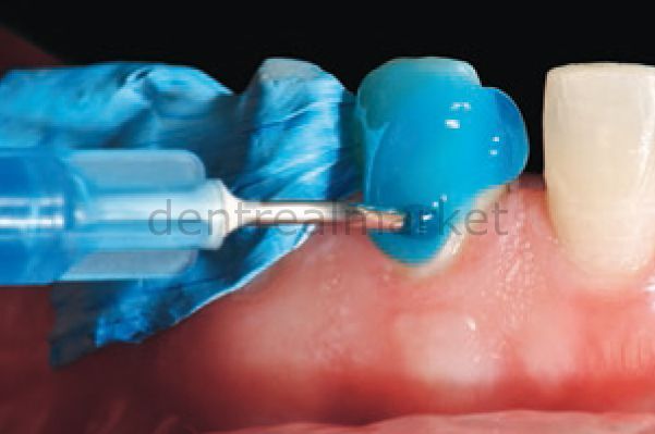 SeptoTape Koruyucu İzelasyon Bandı