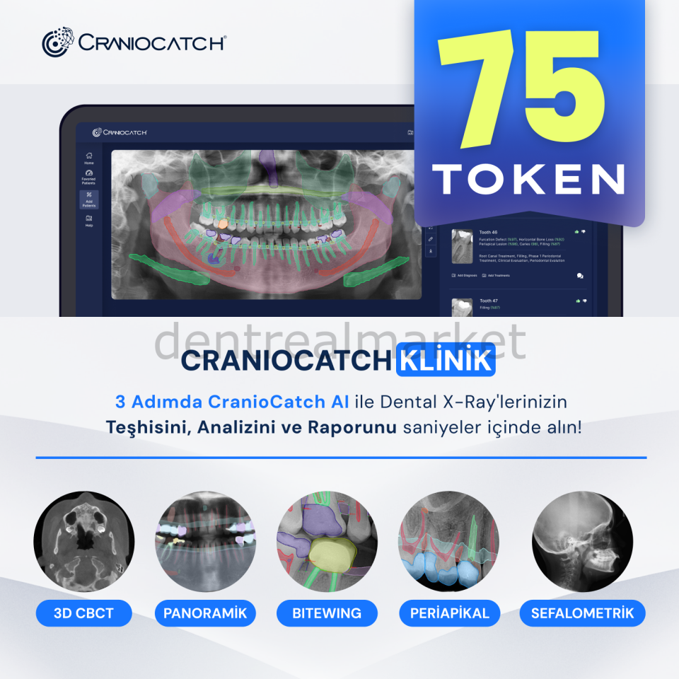 AI ile Dental X-Ray İçin Teşhis, Analiz ve Rapor - 75 Token