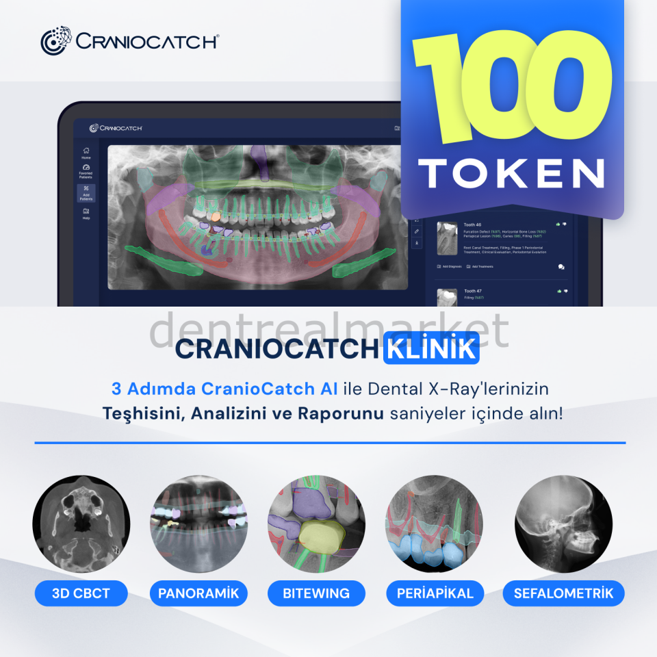 AI ile Dental X-Ray İçin Teşhis, Analiz ve Rapor - 100 Token