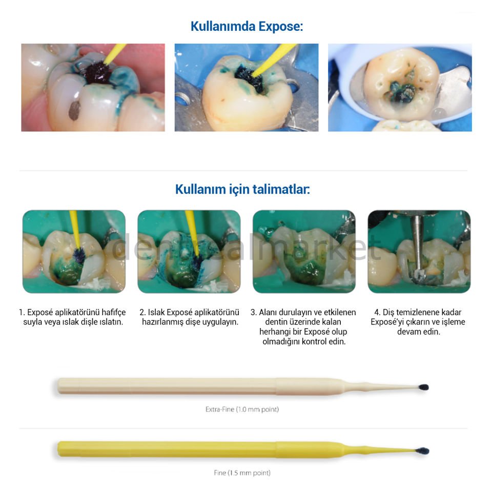 Expose Tek Kullanımlık Çürük Belirleyici Extra Fine 1.0 mm