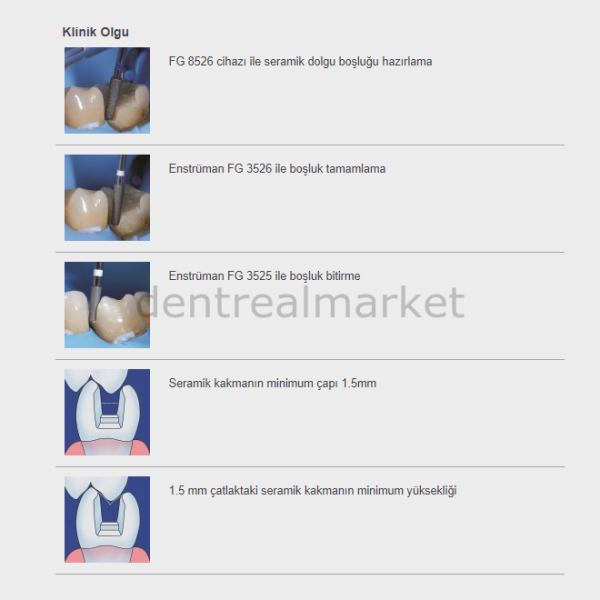 Cerinley Set İnley kavite hazırlama seti