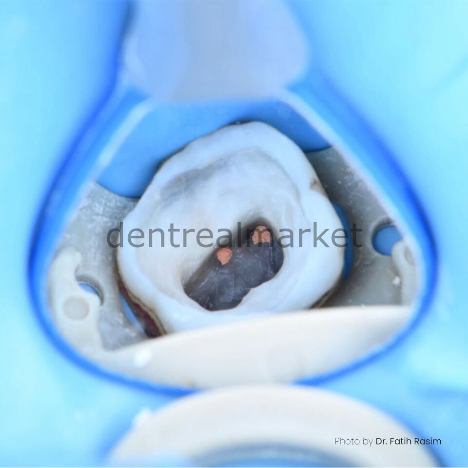 Yirro Pilot 6'lı Ayna Seti