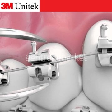Gemini SL Kapaklı Metal Braket