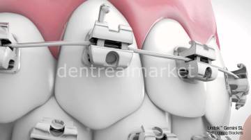 Gemini SL Kapaklı Metal Braket