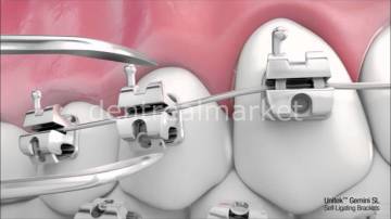 Gemini SL Kapaklı Metal Braket