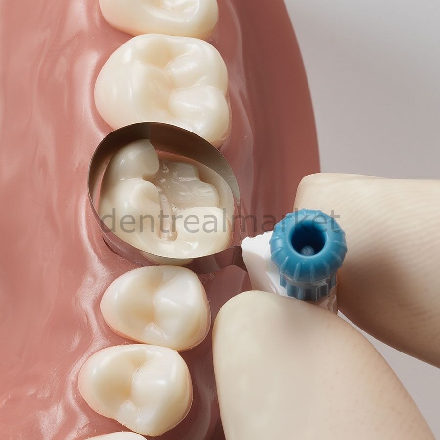 Palodent 360 Çevresel Matrix Refil
