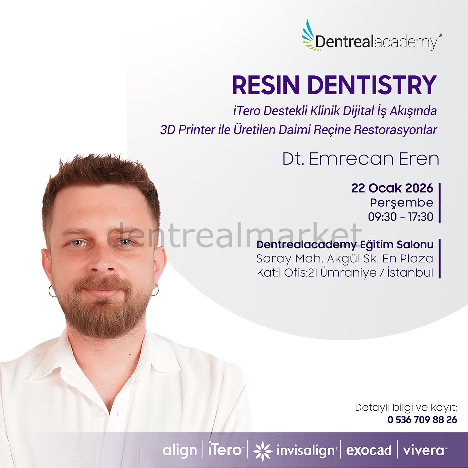 Resin Dentistry İtero Destekli Klinik Dijital İş Akışında 3D Printer ile Üretilen Daimi Reçine Restorasyonlar - Dt. Emrecan Eren