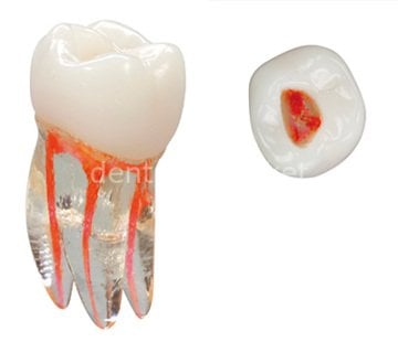 Training Tooth Molar Egitim Dişi