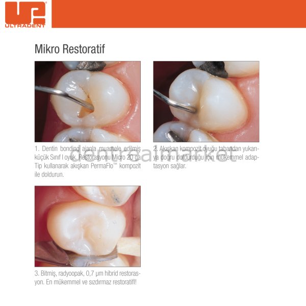 PermaFlo Flow Dentin Opaquer Akışkan Kompozit Refil